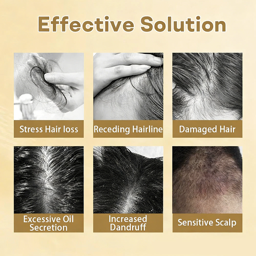 Best Seller 🎉limited-time discount | Acezozla® Hair Regrowth Capsules 💖Revive Follicles, Boost Hair Volume